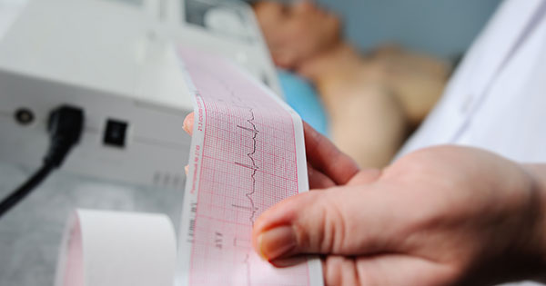 Eletrocardiograma2 Eletrocardiograma2
